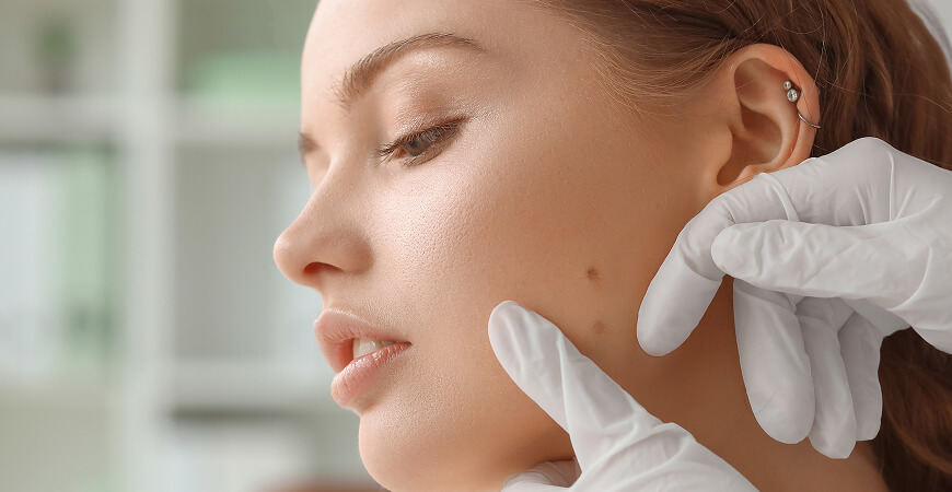 Leistung Hauttumore - MKG-Chirurgie Hamburg-Rahlstedt - PD Dr. Dr. Stefan Kindler